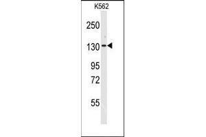 Image no. 1 for anti-Valyl-tRNA Synthetase (VARS) (N-Term) antibody (ABIN360195) (VARS antibody  (N-Term))
