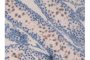 Detection of MGEA5 in Mouse Testis Tissue using Polyclonal Antibody to Meningioma Expressed Antigen 5 (MGEA5) (MGEA5 antibody  (AA 83-222))