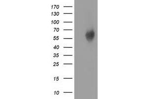 HEK293T cells were transfected with the pCMV6-ENTRY control (Left lane) or pCMV6-ENTRY EXD1 (Right lane) cDNA for 48 hrs and lysed. (EXD1 antibody)