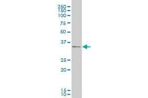 CXCR4 monoclonal antibody (M04), clone 2G9. (CXCR4 antibody  (AA 1-46))
