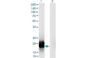 Western Blot analysis of GTSF1L expression in transfected 293T cell line by GTSF1L monoclonal antibody (M03), clone 5E7. (GTSF1L antibody  (AA 1-148))