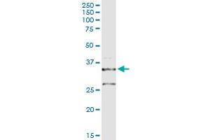 Western Blotting (WB) image for anti-Proopiomelanocortin (POMC) (AA 1-267) antibody (ABIN519039)