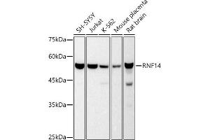 Western blot analysis of extracts of various cell lines, using RNF14 antibody (ABIN7270060) at 1:500 dilution. (RNF14 antibody)