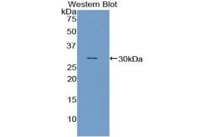 Western blot analysis of recombinant Mouse NUP88.