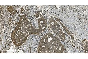 IHC analysis of U2AF65/U2AF2 using anti U2AF65/U2AF2 antibody (ABIN7600794). (U2AF2 antibody  (AA 238-470))