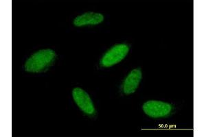 Immunofluorescence of purified MaxPab antibody to RBM23 on HeLa cell. (RBM23 antibody  (AA 1-424))