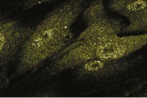 HISM cells grown on microscope slides and stained with Smad2/3 antibody. (Smad2/3 antibody  (AA 142-263))