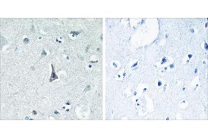 Peptide - +Immunohistochemistry analysis of paraffin-embedded human brain tissue using Cytochrome P450 3A4 antibody. (CYP3A4 antibody)