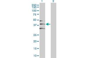 Western Blot analysis of CDK2 expression in transfected 293T cell line by CDK2 MaxPab polyclonal antibody. (CDK2 antibody  (AA 1-298))