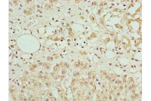 Immunohistochemistry of paraffin-embedded human adrenal gland tissue using ABIN7144341 at dilution of 1:100 (Antizyme Inhibitor 1 antibody  (AA 101-400))