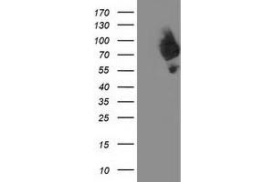 HEK293T cells were transfected with the pCMV6-ENTRY control (Left lane) or pCMV6-ENTRY DPP3 (Right lane) cDNA for 48 hrs and lysed. (DPP3 antibody)