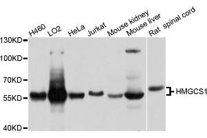 Western blot analysis of extracts of various cell lines, using HMGCS1 antibody. (HMGCS1 antibody)