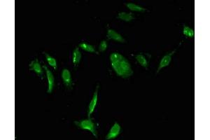 Immunofluorescent analysis of Hela cells using ABIN7172123 at dilution of 1:100 and Alexa Fluor 488-congugated AffiniPure Goat Anti-Rabbit IgG(H+L) (TYMS antibody  (AA 2-54))