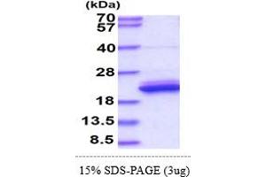 SDS-PAGE (SDS) image for Lipocalin 1 (LCN1) (AA 19-176) protein (His tag) (ABIN5777845)