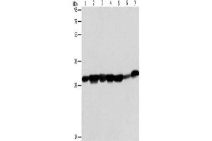 Western Blotting (WB) image for anti-Adenylate Kinase 2 (AK2) antibody (ABIN2422843) (Adenylate Kinase 2 antibody)
