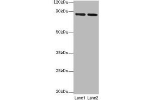 Western blot All lanes: FOLH1 antibody at 2 μg/mL Lane 1: U251 whole cell lysate Lane 2: PC-3 whole cell lysate Secondary Goat polyclonal to rabbit IgG at 1/10000 dilution Predicted band size: 85, 13, 10, 78, 83, 81, 79, 51 kDa Observed band size: 85 kDa (PSMA antibody  (AA 48-750))