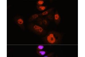 Immunofluorescence analysis of HeLa cells using Phospho-YAP1(S127) Polyclonal Antibody at dilution of 1:100 (40x lens). (YAP1 antibody  (pSer127))