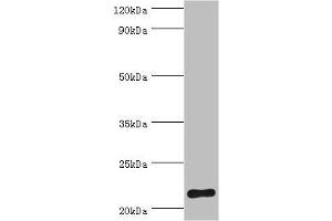 Western blot All lanes: Suppressor of cytokine signaling 2 antibody at 2 μg/mL + HepG2 whole cell lysate Secondary Goat polyclonal to rabbit IgG at 1/10000 dilution Predicted band size: 22 kDa Observed band size: 22 kDa (SOCS2 antibody  (AA 1-198))