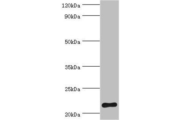 SOCS2 anticorps  (AA 1-198)