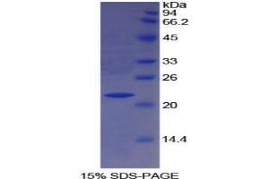 SDS-PAGE analysis of Human Paraoxonase 1 Protein. (PON1 Protein)
