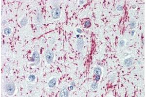 Human Brain, Cortex (formalin-fixed, paraffin-embedded) stained with MBP antibody ABIN364503 at 1:100 followed by biotinylated goat anti-rabbit IgG secondary antibody ABIN481713, alkaline phosphatase-streptavidin and chromogen. (MBP antibody)