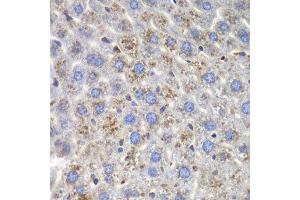 Immunohistochemistry of paraffin-embedded mouse liver using SND1 antibody at dilution of 1:100 (40x lens). (SND1 antibody)