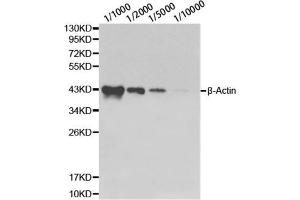 Western blot analysis of HeLa cell using β-actin antibody at different dilutions. (beta Actin antibody)