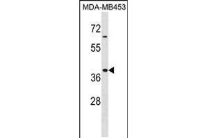Western blot analysis in MDA-MB453 cell line lysates (35ug/lane). (HOXA9 antibody  (AA 160-189))