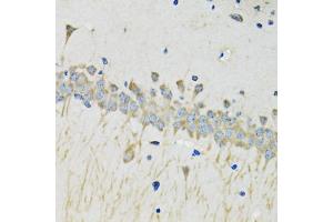 Immunohistochemistry of paraffin-embedded mouse brain using SERPINA4 antibody (ABIN5975715) at dilution of 1/100 (40x lens). (SERPINA4 antibody)