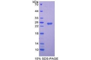 SDS-PAGE (SDS) image for Vinculin (VCL) (AA 879-1064) protein (His tag) (ABIN2127230)