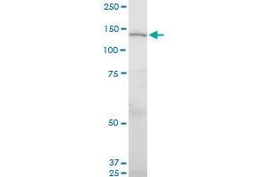 UNC13D monoclonal antibody (M05), clone 2C7. (UNC13D antibody  (AA 2-100))