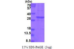 SDS-PAGE (SDS) image for Kallikrein-Related Peptidase 13 (KLK13) (AA 17-277) protein (His tag) (ABIN6387541) (Kallikrein 13 Protein (AA 17-277) (His tag))