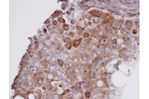 IHC-P Image Immunohistochemical analysis of paraffin-embedded H441 xenograft, using GPX7 , antibody at 1:100 dilution. (Glutathione Peroxidase 7 antibody)