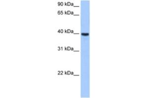 Western Blotting (WB) image for anti-ST6 (Alpha-N-Acetyl-Neuraminyl-2,3-beta-Galactosyl-1,3)-N-Acetylgalactosaminide alpha-2,6-Sialyltransferase 4 (ST6GALNAC4) antibody (ABIN2463264) (ST6GALNAC4 antibody)