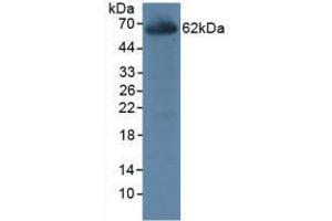 Western blot analysis of Rat Liver Tissue. (CES1 antibody  (AA 19-300))