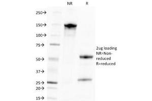 SDS-PAGE Analysis of Purified, BSA-Free CMV Antibody (clone CMV100).