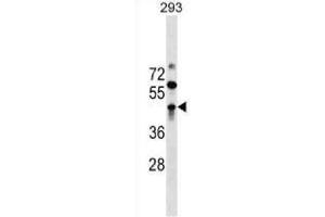 Western blot analysis in 293 cell line lysates (35 ug/ml) using. (ZBTB32 antibody  (AA 96-125) (APC))