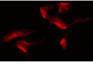 ABIN6275562 staining 293 by IF/ICC. (SH2D5 antibody  (C-Term))