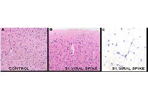 IHC Results in mice after tail vein injection of spike S1 subunit. (SARS-CoV-2 Spike S1 antibody)