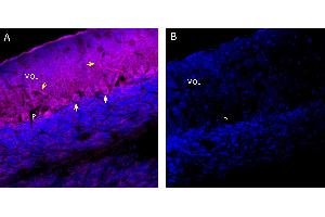 Free-floating frozen brain sections from a paraformaldehyde-perfused mouse were incubated with Anti-CaV1.