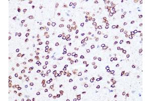 Immunohistochemistry of paraffin-embedded rat brain using Lamin B2 Rabbit mAb (ABIN1679310, ABIN3019324, ABIN3019325 and ABIN7101750) at dilution of 1:100 (40x lens). (Lamin B2 antibody)