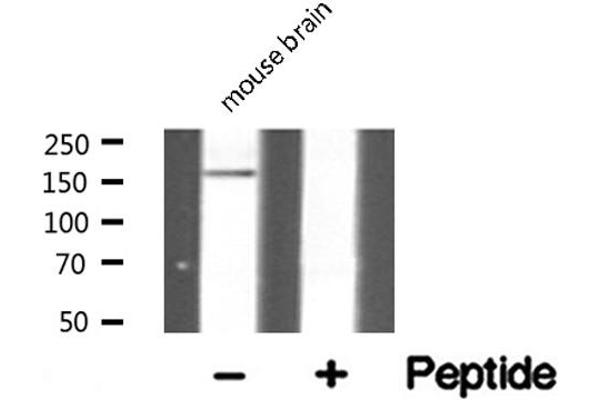 DGKI antibody  (C-Term)
