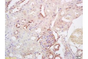 Formalin-fixed and paraffin embedded rat kidney labeled with Rabbit Anti SULT2A1 Polyclonal Antibody, Unconjugated (ABIN712916) at 1:200 followed by conjugation to the secondary antibody and DAB staining (SULT2A1 antibody  (AA 91-170))