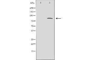 Western blot analysis of brain  lysate usingCTCF antibody. (CTCF antibody  (C-Term))