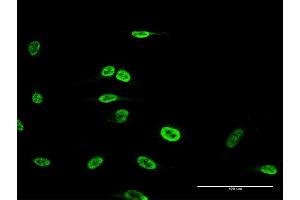 Immunofluorescence of monoclonal antibody to FOXP2 on HeLa cell. (FOXP2 antibody  (AA 616-715))