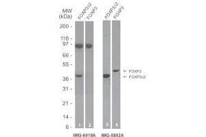 Image no. 1 for anti-Forkhead Box P3 (FOXP3) antibody (ABIN959877) (FOXP3 antibody)