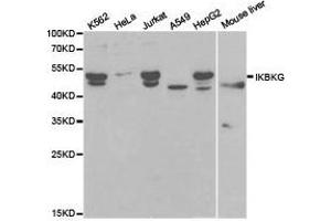 Western Blotting (WB) image for anti-Inhibitor of kappa Light Polypeptide Gene Enhancer in B-Cells, Kinase gamma (IKBKG) antibody (ABIN1873181) (IKBKG antibody)