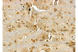 ABIN6266313 and ABIN6277430 at 1/100 staining Rat brain tissue by IHC-P. (RAD52 antibody  (Internal Region))