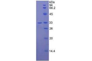 SDS-PAGE analysis of Human Jagged 2 Protein.