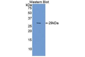 Western Blotting (WB) image for anti-DNA Repair Protein Complementing XP-G Cells (ERCC5) (AA 778-986) antibody (ABIN1860966) (ERCC5 antibody  (AA 778-986))